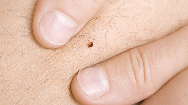 Hände auf Haut mit Zicke dazwischen